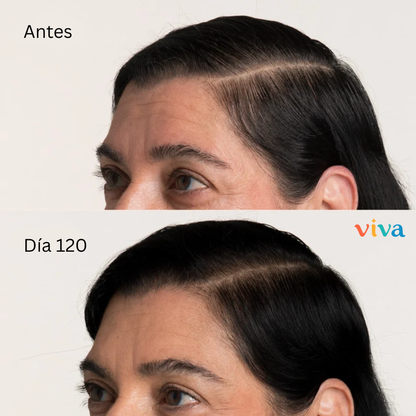 Hair Growth Crecimiento Cabello